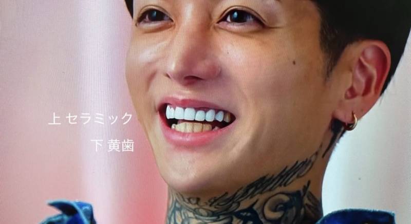 불량연애2 보는 시청자들 신경 쓰이게 만드는 남출 치아의 내용을 보여주는 이미지