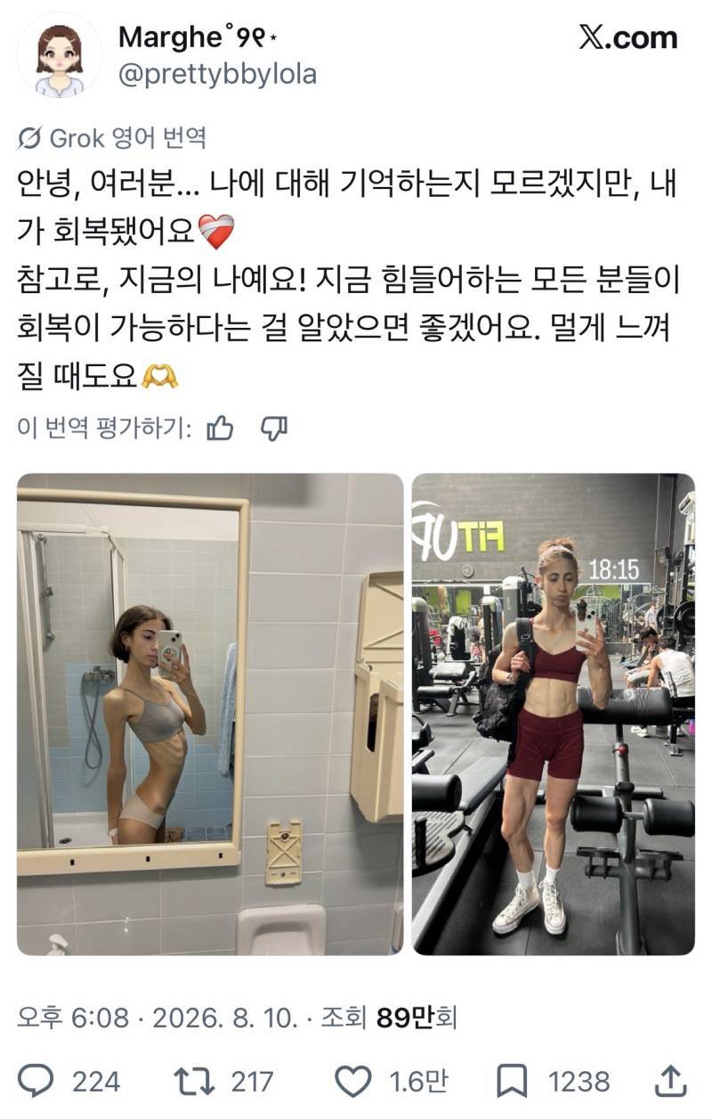 극단적 마름에서 건강해진 사람들의 내용을 보여주는 이미지