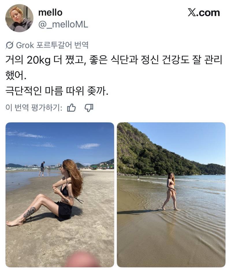 극단적 마름에서 건강해진 사람들의 내용을 보여주는 이미지 관련 이미지 3