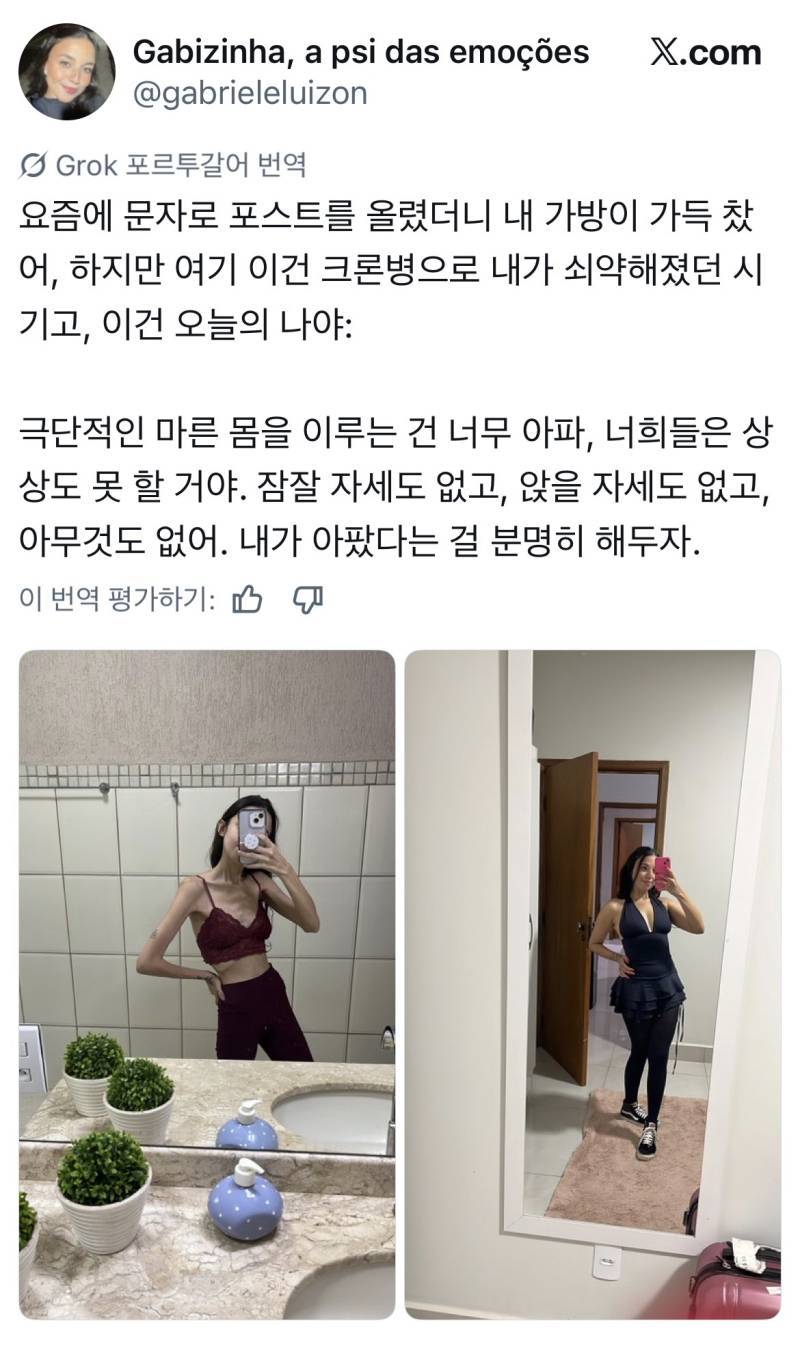 극단적 마름에서 건강해진 사람들의 내용을 보여주는 이미지 관련 이미지 4
