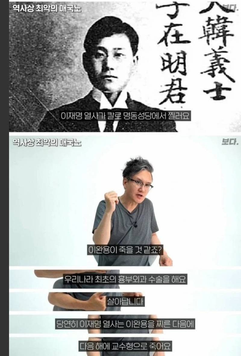 이번에 사람들이 알게 된 우리나라 최초의 흉부외과 수술의 내용을 보여주는 이미지