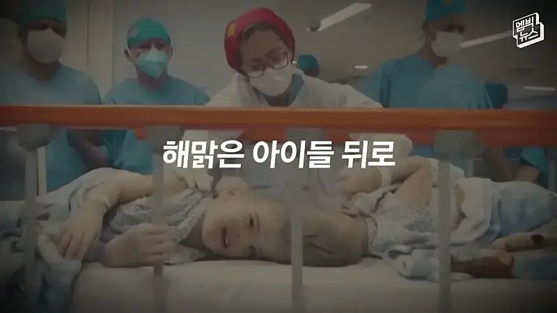 33시간 수술 끝에 얼굴 본 쌍둥이.jpg
