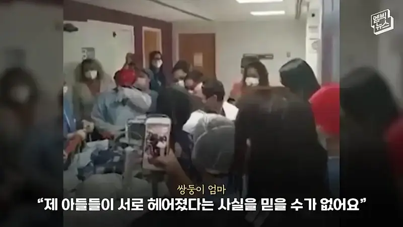 33시간 수술 끝에 얼굴 본 쌍둥이.jpg