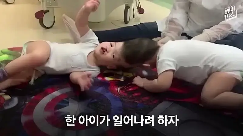 33시간 수술 끝에 얼굴 본 쌍둥이.jpg