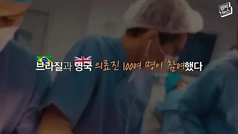 33시간 수술 끝에 얼굴 본 쌍둥이.jpg