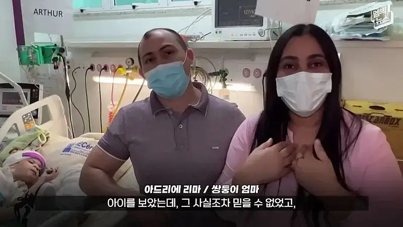 33시간 수술 끝에 얼굴 본 쌍둥이.jpg