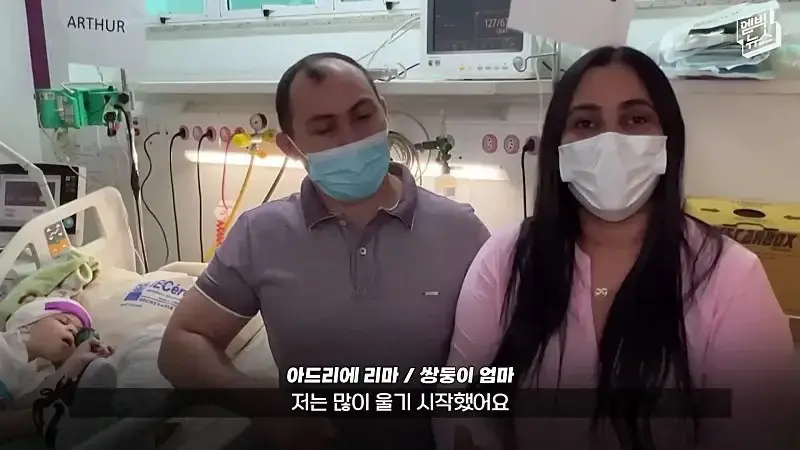 33시간 수술 끝에 얼굴 본 쌍둥이.jpg
