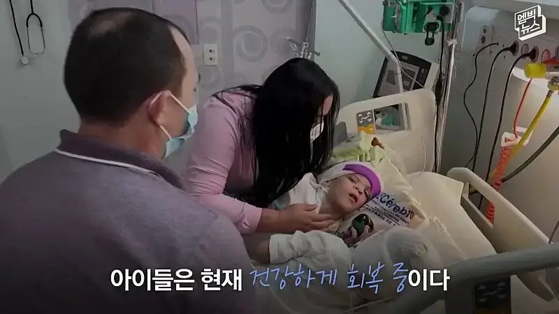 33시간 수술 끝에 얼굴 본 쌍둥이.jpg