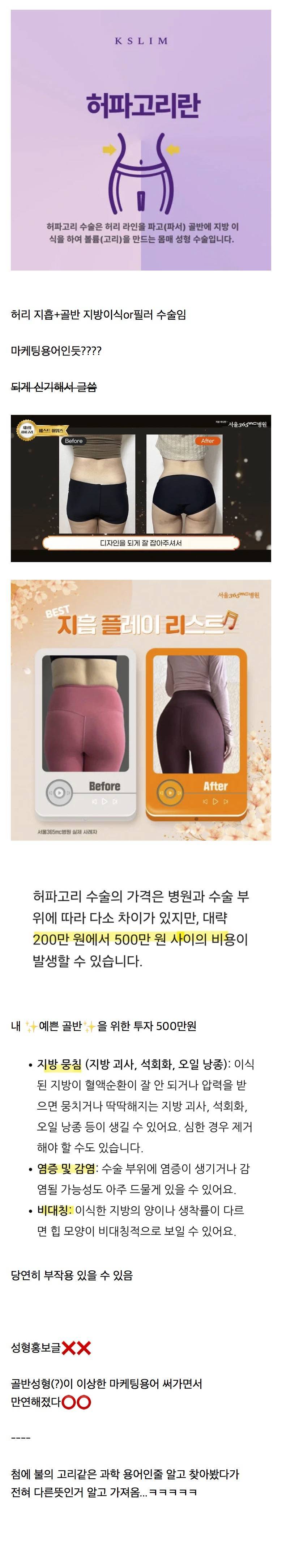 이름 바꿔서 한국에 들어온 BBL(엉덩이 키우기) 수술의 내용을 보여주는 이미지 관련 이미지 4