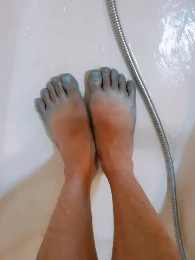 리스테린으로 무좀 제거 시도 결과물 ㄷ�의 내용을 보여주는 이미지 관련 이미지 4