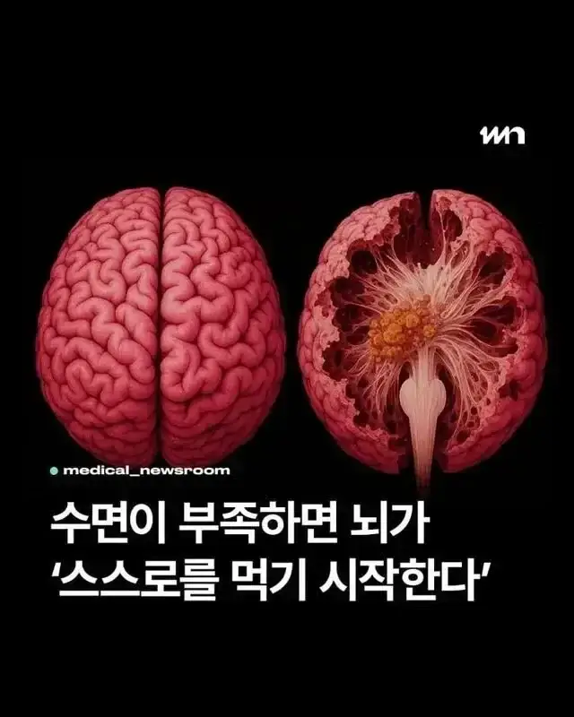 수면이 부족하면 뇌가 스스로를 먹기 시작의 내용을 보여주는 이미지
