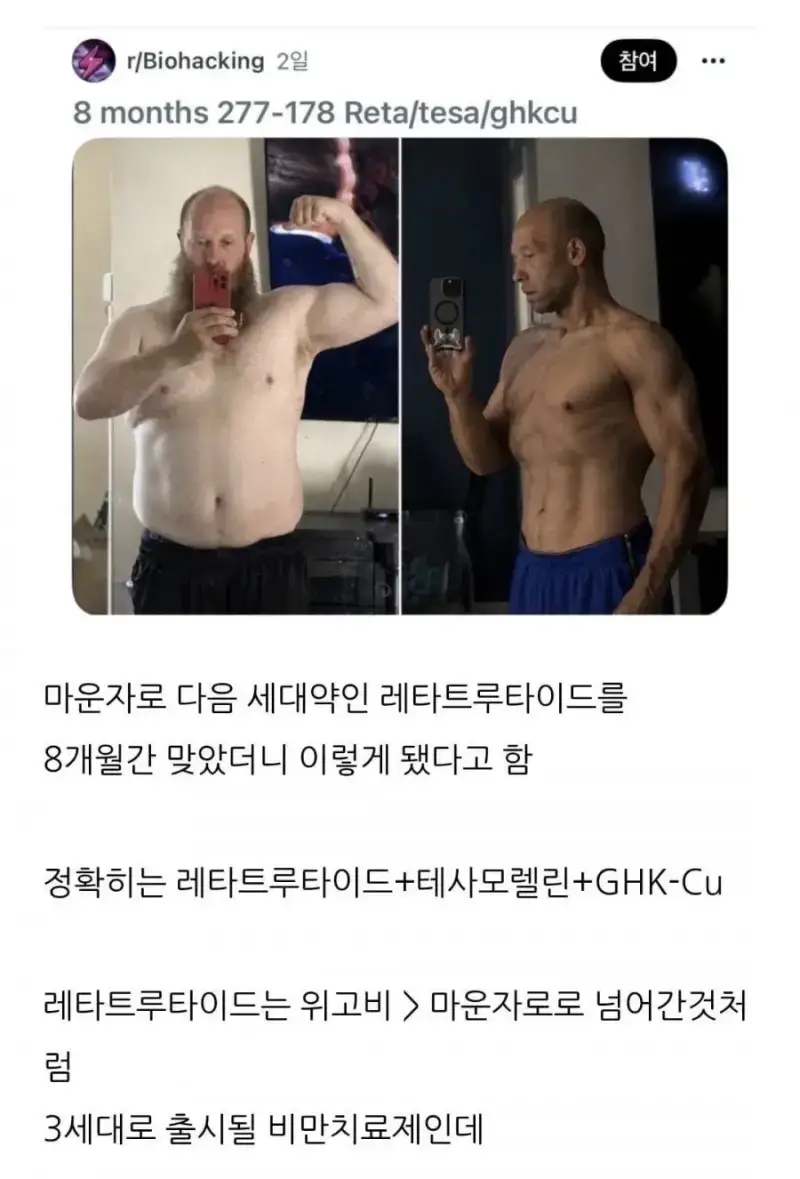 현재) 난리난 차세대 꿈의 비만치료제 ㄷㄷ