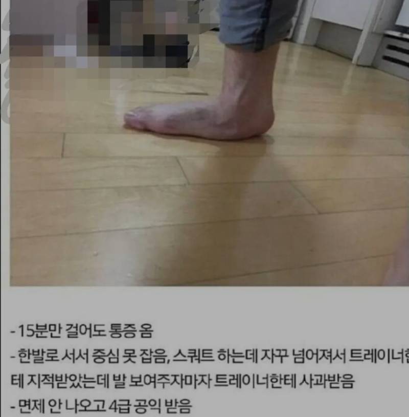 군 면제 받았다는 평발의 내용을 보여주는 이미지
