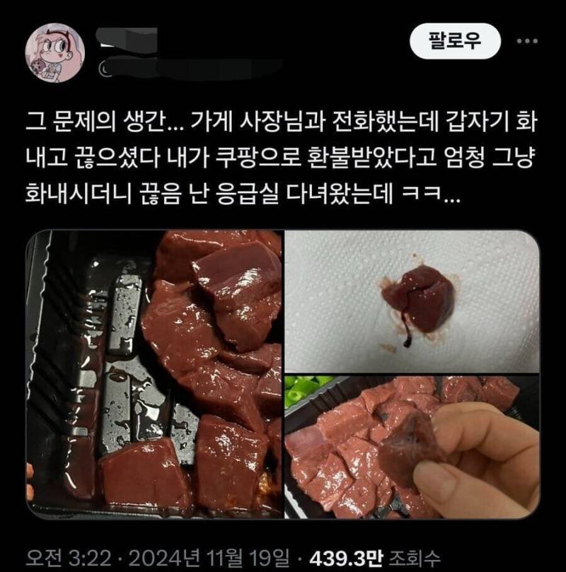 생간 배달로 시켜먹은 사람의 최후의 내용을 보여주는 이미지 관련 이미지 2