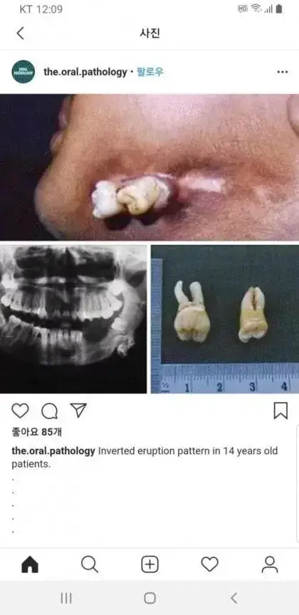 전생 매국노 사랑니 모음의 내용을 보여주는 이미지
