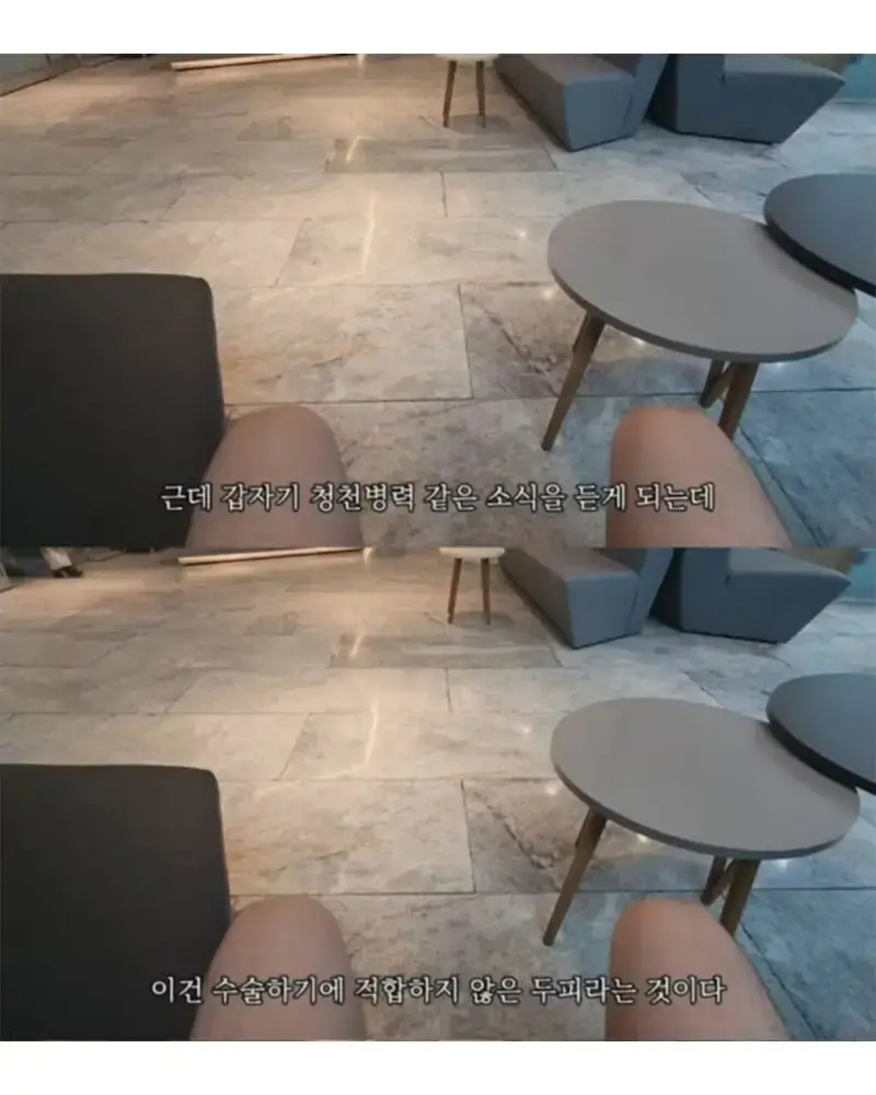 4ee69cd04c8e400b90bdbd6da41f9ea4.jpg 터키로 모발이식 받으러간 남자의 최후.jpg