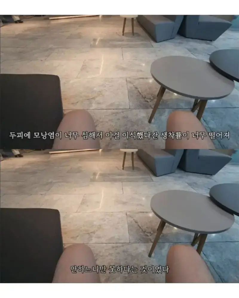 9aff4cce2ff042e9a7d7b595b1e90f02.jpg 터키로 모발이식 받으러간 남자의 최후.jpg