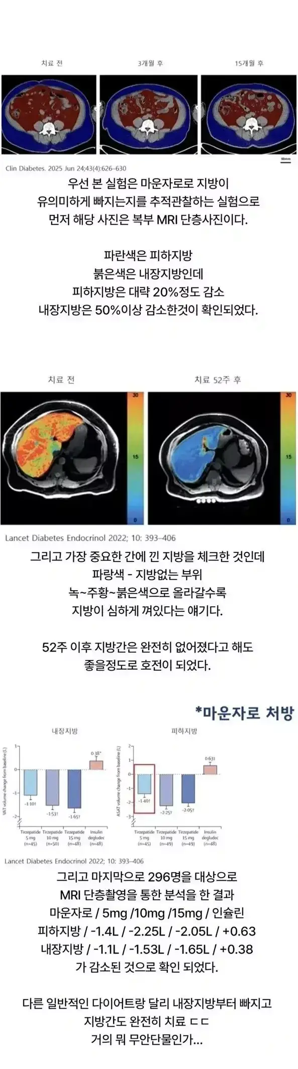 마운자로 1년 맞았더니 내장지방에 생긴 변화의 내용을 보여주는 이미지