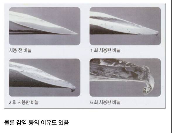 7doseRzuGA48KEY4OKMQme.jpg