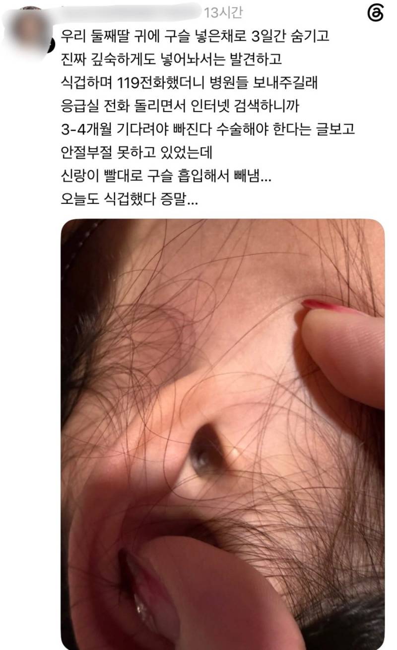 귀에 구슬 넣고 3일간 숨기고 말안한 둘째딸..의 내용을 보여주는 이미지