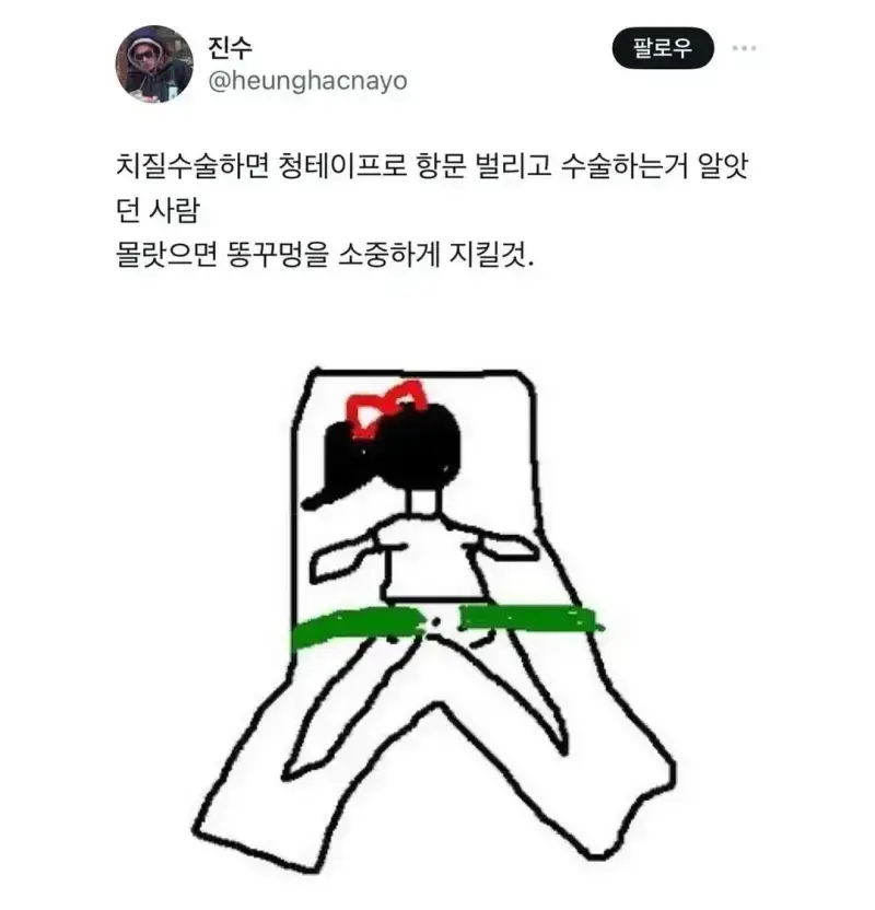 치욕 그 자체라는 치질 수술할때 해야 한다는 자세의 내용을 보여주는 이미지 관련 이미지 2