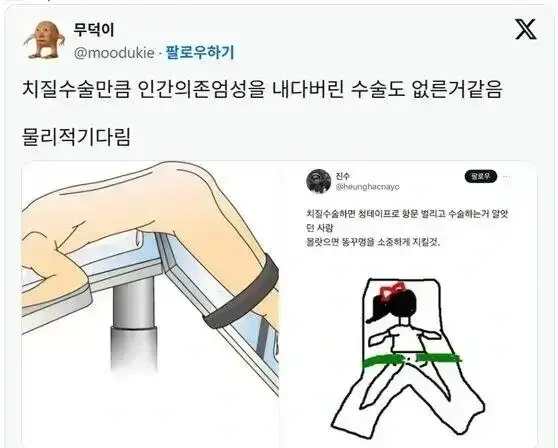 치욕 그 자체라는 치질 수술할때 해야 한다는 자세의 내용을 보여주는 이미지 관련 이미지 3