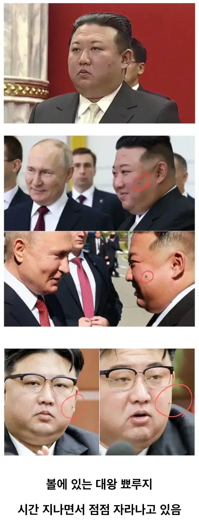 김정은 얼굴에서 점점 자라나고 있는 것의 내용을 보여주는 이미지