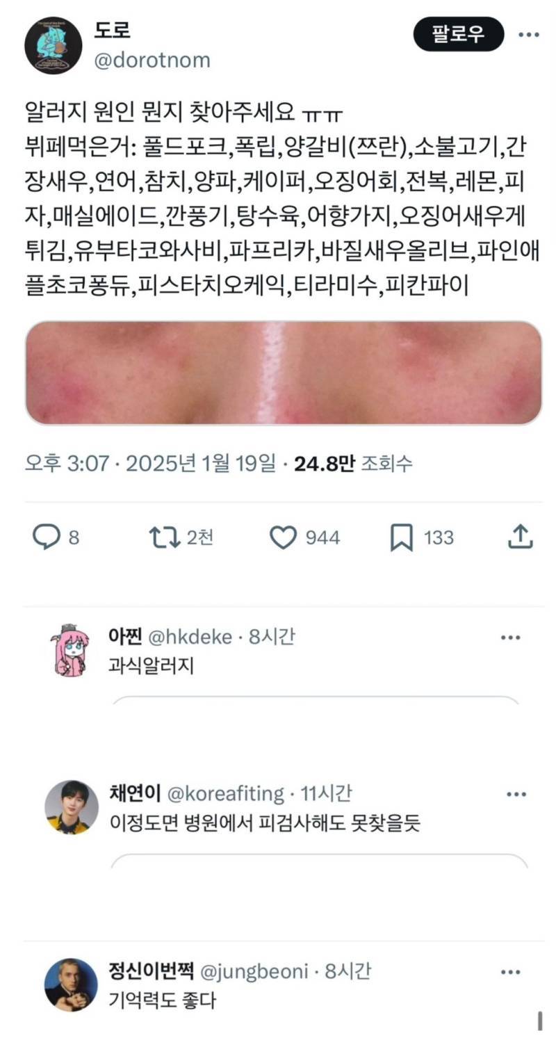 뷔페먹고 알러지 온 사람의 내용을 보여주는 이미지