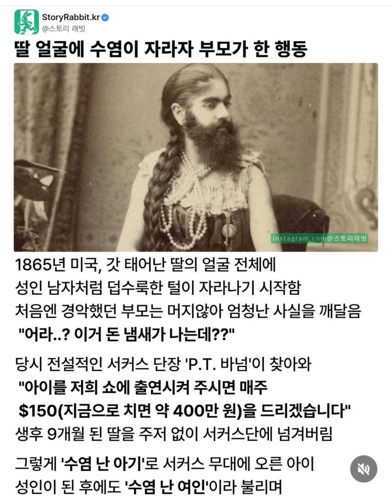 딸 얼굴에 수염이 자라자 부모가 한 행동의 내용을 보여주는 이미지