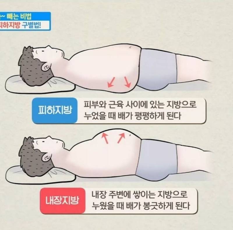 피하지방과 내장지방 차이의 내용을 보여주는 이미지