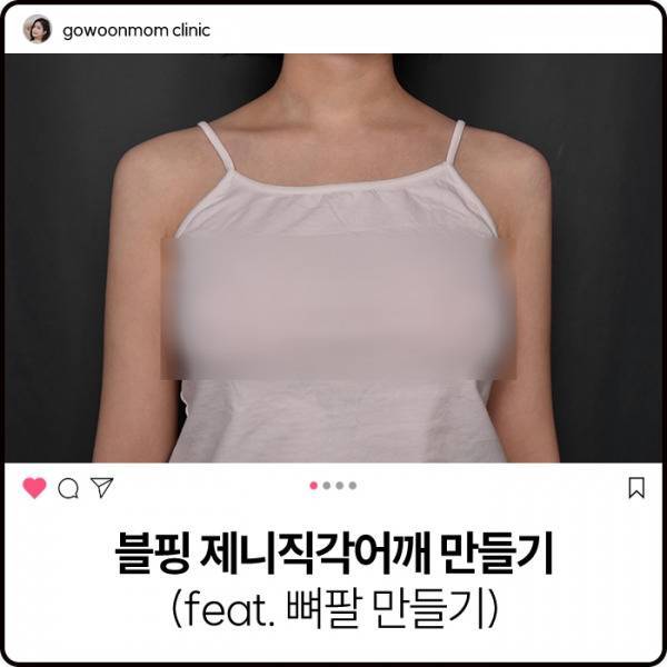 요새 다이어트 대세 - 뼈말라 뼈팔뚝의 내용을 보여주는 이미지