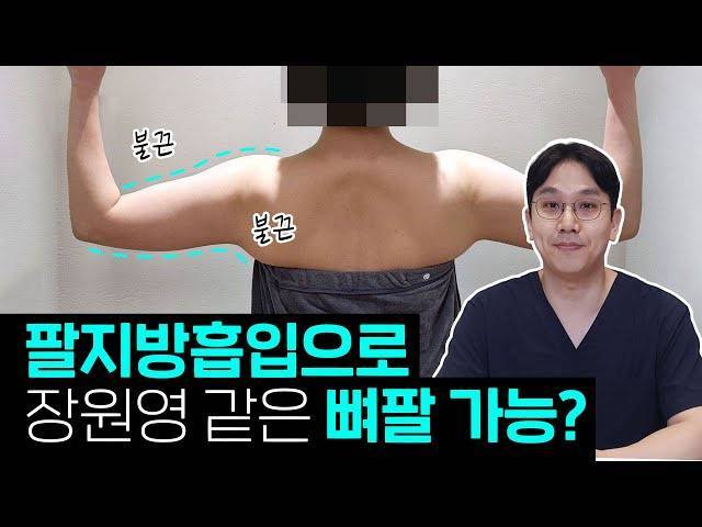 요새 다이어트 대세 - 뼈말라 뼈팔뚝의 내용을 보여주는 이미지 관련 이미지 2