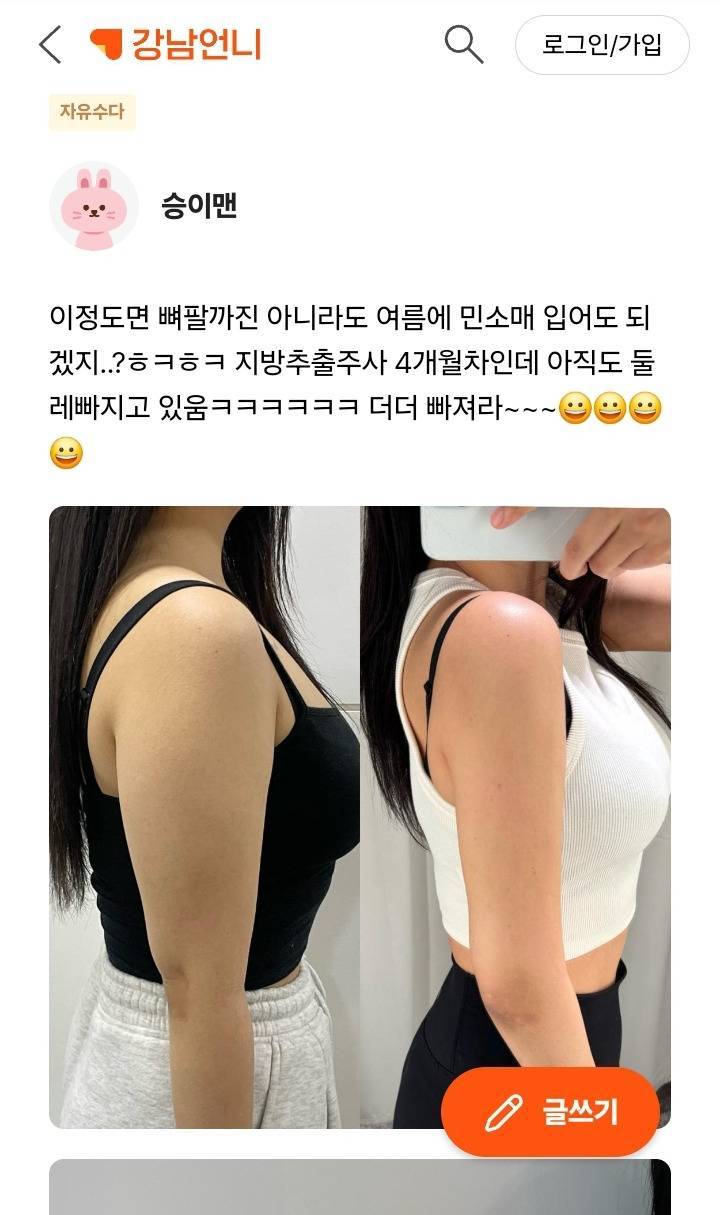 요새 다이어트 대세 - 뼈말라 뼈팔뚝의 내용을 보여주는 이미지 관련 이미지 6