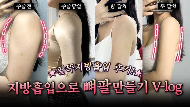 요새 다이어트 대세 - 뼈말라 뼈팔뚝의 내용을 보여주는 이미지 관련 이미지 7