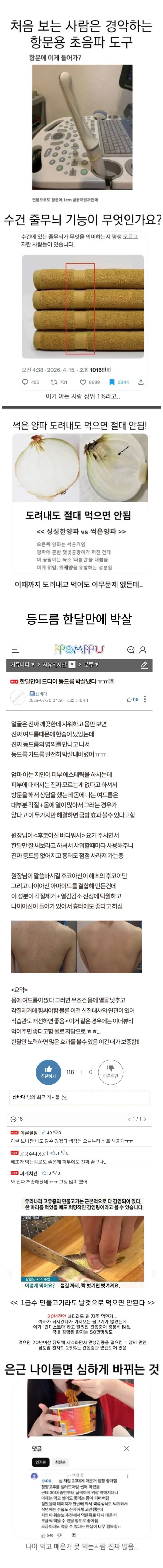 충격적인 항문용 초음파 기구 ㄷㄷㄷㄷ..의 내용을 보여주는 이미지