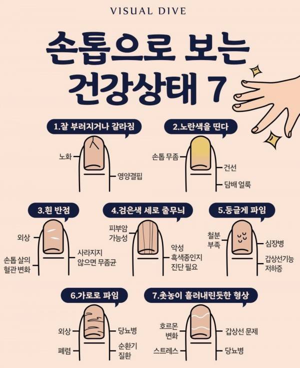 손톱으로 보는 건강 상태 7의 내용을 보여주는 이미지